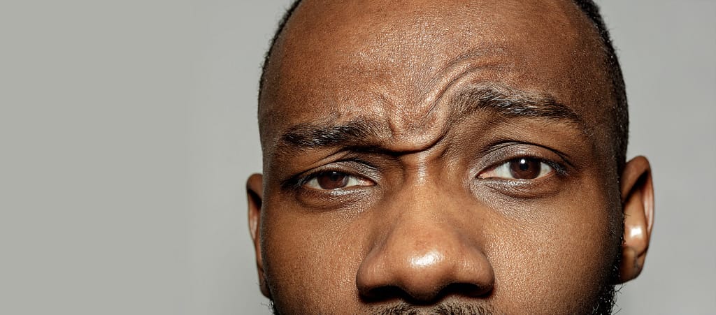 Imagen de refuerzo para la introducción de entrada El envejecimiento de la piel