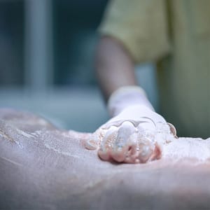 preoperatorio-sanit-scrub Aplicación de producto en la antisepsia de piel preoperatório con Sanir SCRUB