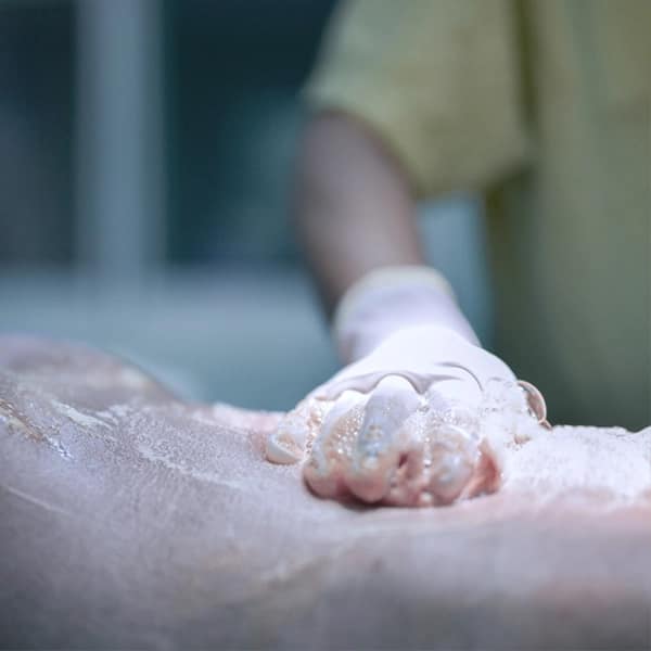 preoperatorio-sanit-scrub Aplicación de producto en la antisepsia de piel preoperatório con Sanir SCRUB